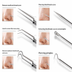 8-Piece Blackhead & Blemish Extractor Tool Set - fundo branco