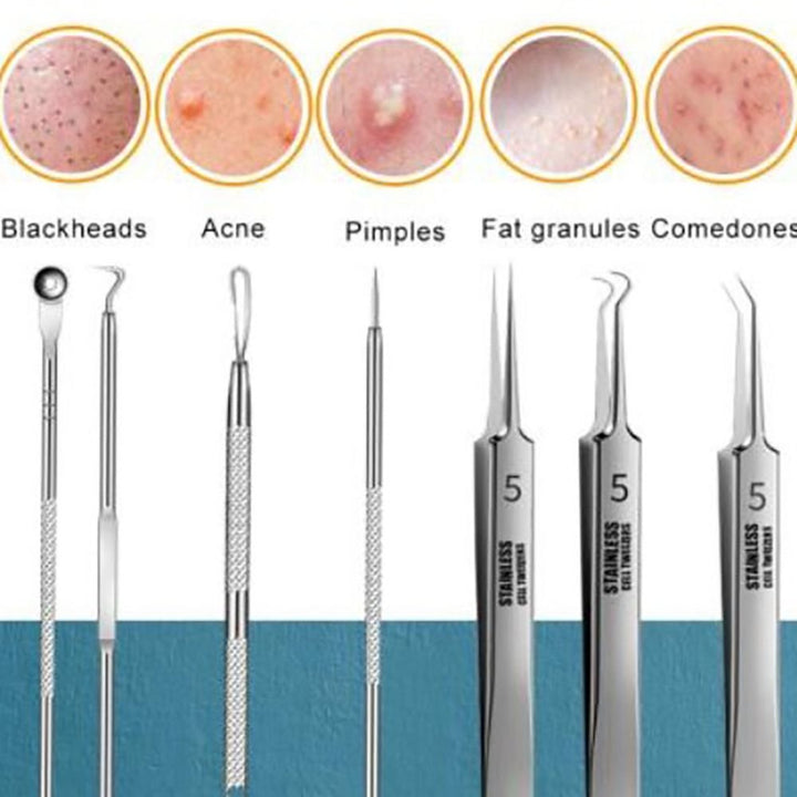 8-piece blackhead and blemish extractor tool set