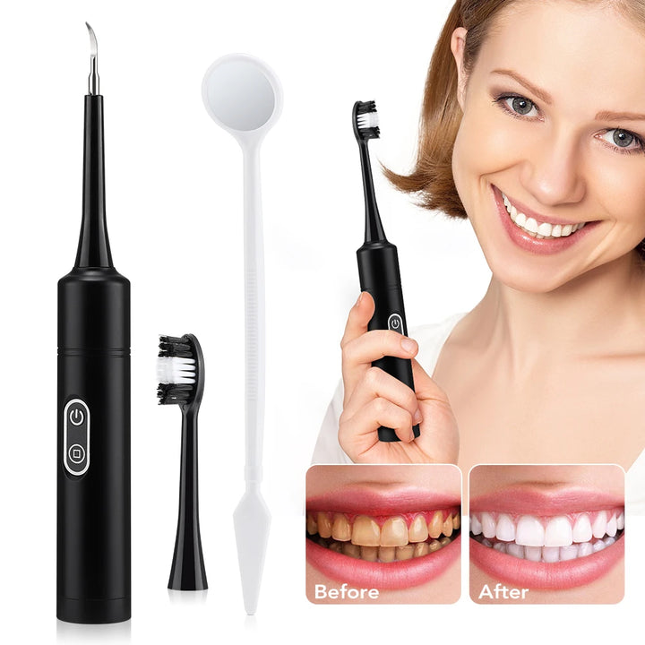 Electric Sonic Tooth Cleaner &amp; Tartar Remover