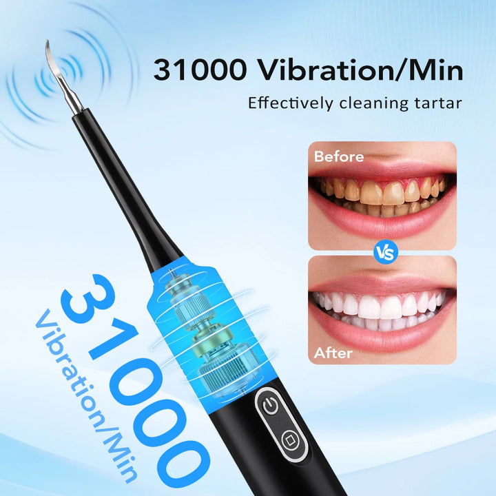 Electric Sonic Tooth Cleaner &amp; Tartar Remover