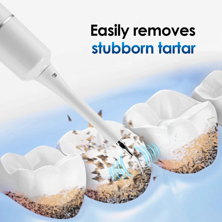 Electric Sonic Tooth Cleaner &amp; Tartar Remover
