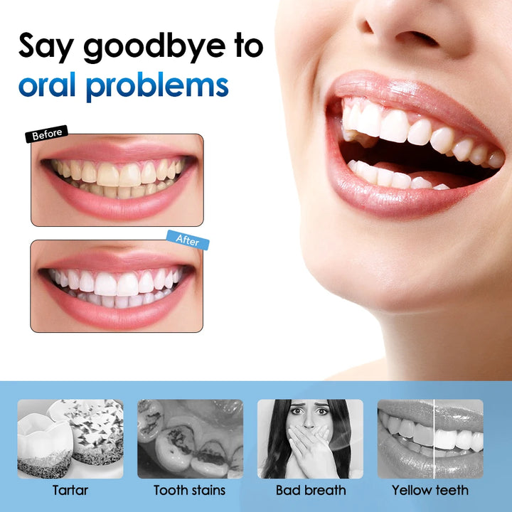 Electric Sonic Tooth Cleaner &amp; Tartar Remover