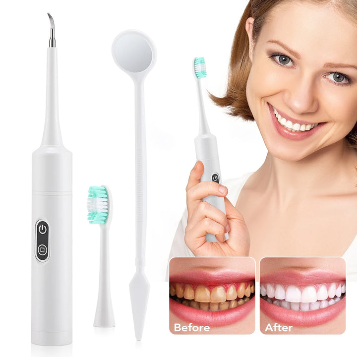Electric Sonic Tooth Cleaner &amp; Tartar Remover