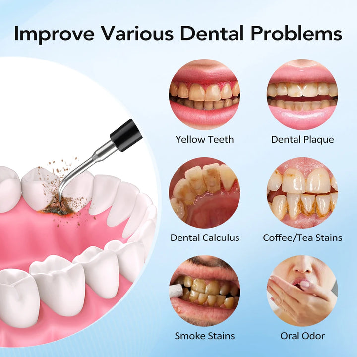 Electric Sonic Tooth Cleaner &amp; Tartar Remover