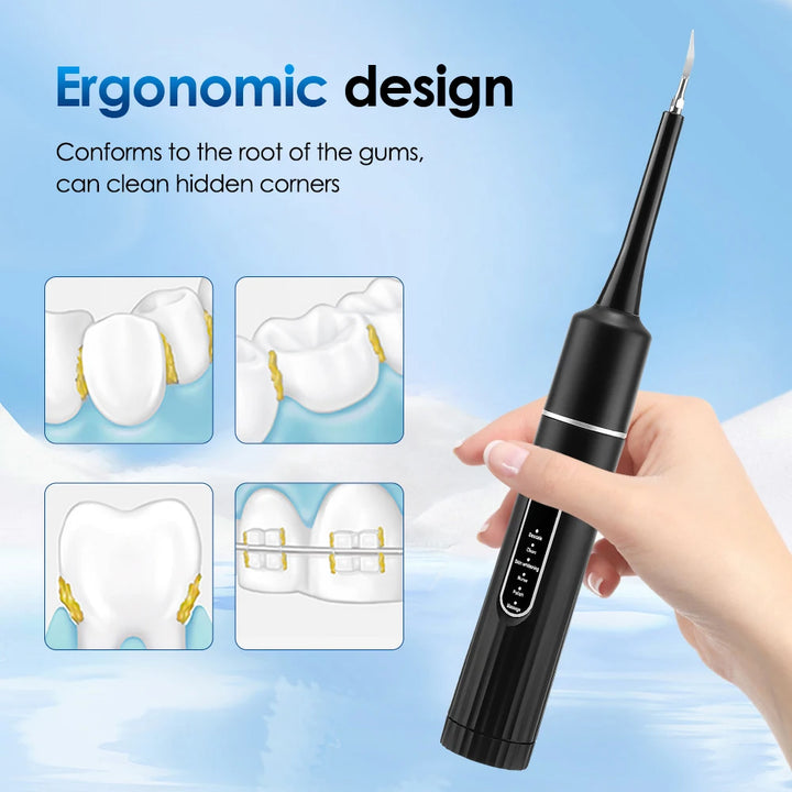 Electric Sonic Tooth Cleaner &amp; Tartar Remover